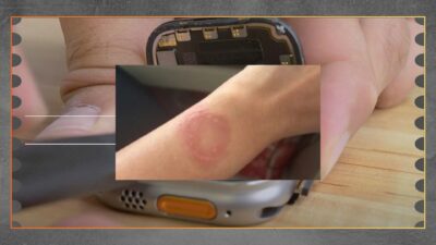 Apple Watch Overheat Picu Luka, Penanganan Lambat